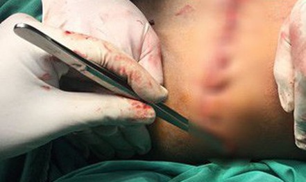 Ăn gì để trị mất ngủ?