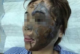 Lần đầu tiên tạo hình