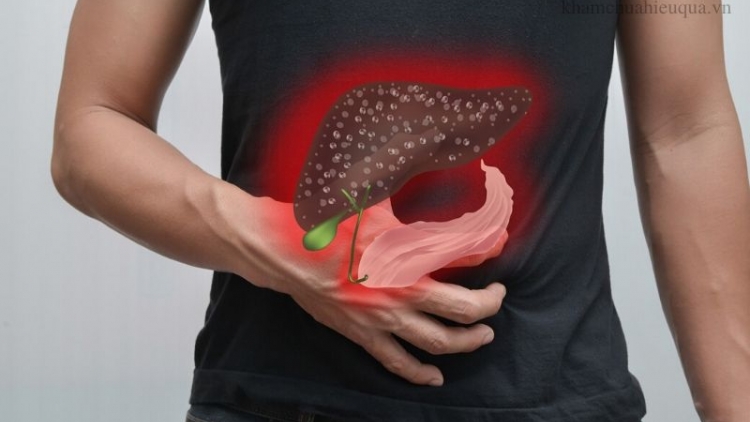 Bệnh gan nhiễm mỡ phải