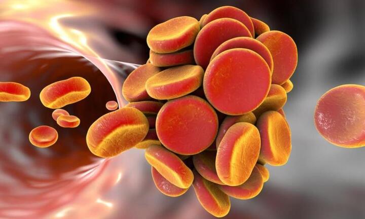 Những thực phẩm giúp đánh tan cục máu đông hiệu quả